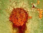 Infected